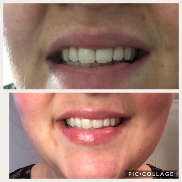 Ap24 Whitening Toothpaste - Picture 2 of 3